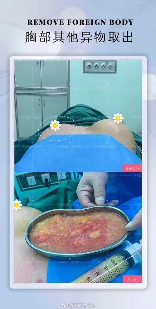 王佑兴医生预约挂号