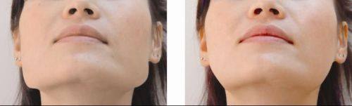 哈尔滨裕都明洋医疗美容真人口碑评价怎么样？