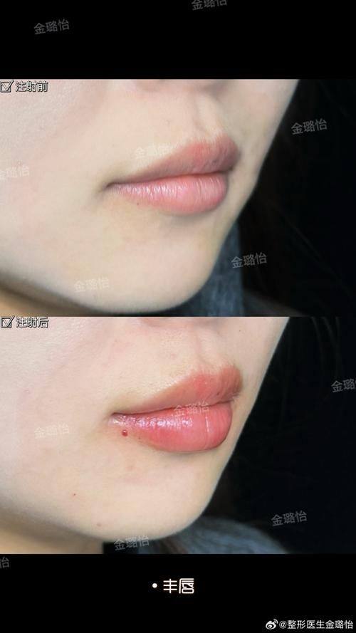 北京佰嘉利医疗美容诊所特色项目及技术优势