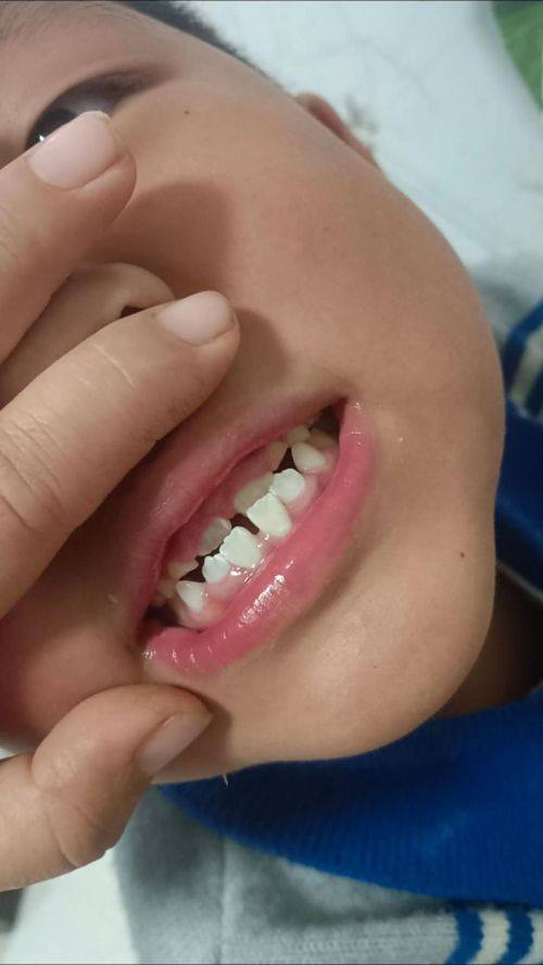 广东广州如壹齿科特色项目及技术优势