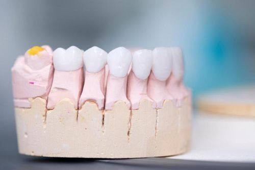 国内医 科 大学附属口腔医院口腔技术工艺中 心真人口碑评价怎么样?