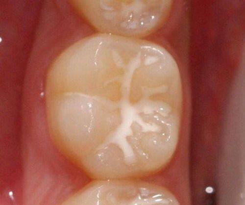 山东德州贝美口腔详细的预约挂号方式及流程