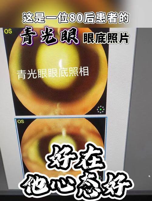 广州飞秒眼科门诊部详细的预约挂号方式及流程