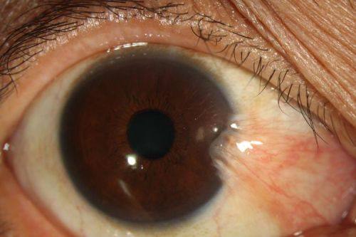 广州飞秒眼科门诊部是正规医院吗?