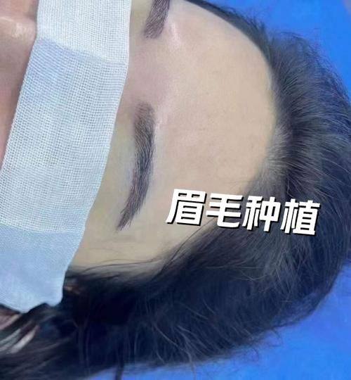 郴州臻妃植发医院真人口碑评价怎么样？