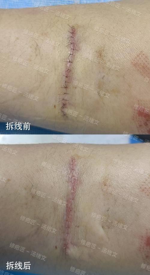 上海维九整形医疗美容门诊部详细的预约挂号方式及流程
