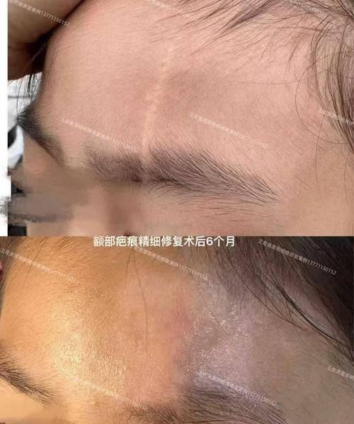 安阳上城整形医院真人口碑评价怎么样?