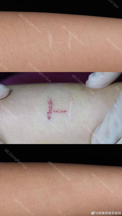 上海维九整形医疗美容门诊部是正规医院吗?