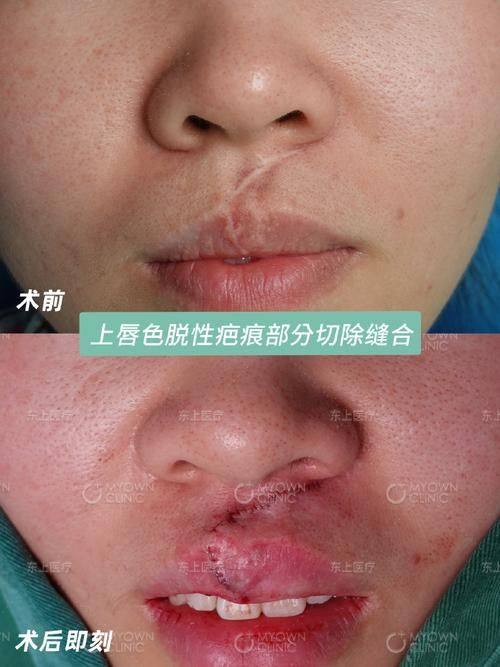 兴隆县天佑医院整形美容科详细的预约挂号方式及流程