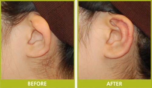 兴隆县天佑医院整形美容科真人口碑评价怎么样?