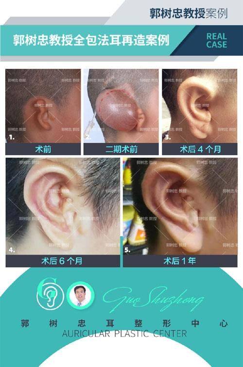 北京佰嘉利医疗美容诊所详细的预约挂号方式及流程