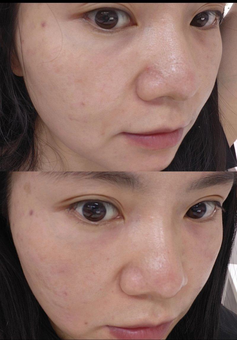 重庆易凡蕴俏医疗美容诊所真人口碑评价怎么样？