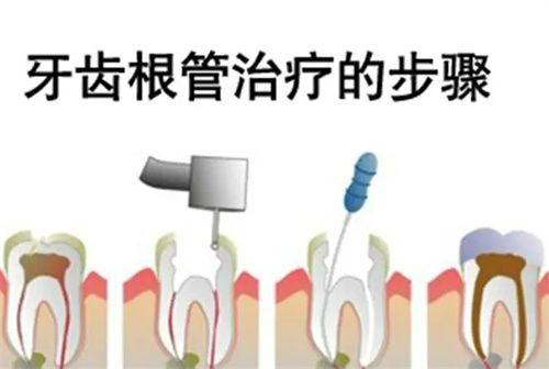 海南海口龙华笛特口腔收费价格表/收费标准