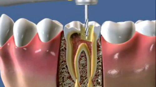 海南海口龙华笛特口腔是正规医院吗？