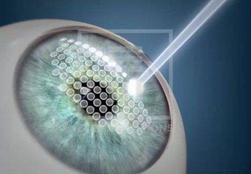 何欣医生口碑评价及真人实例