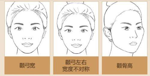 刘芳利医生擅长项目