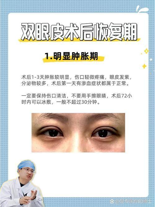 费书宇医生口碑评价及真人实例