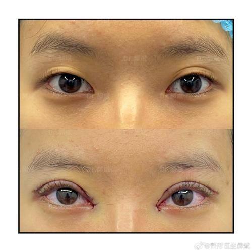 深圳希诺医疗美容门诊部特色项目及技术优势