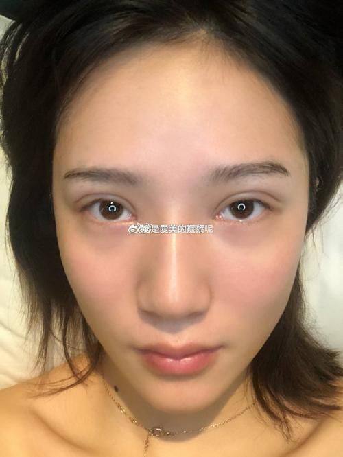 日本LiraCranio面部诊所真人口碑评价怎么样？