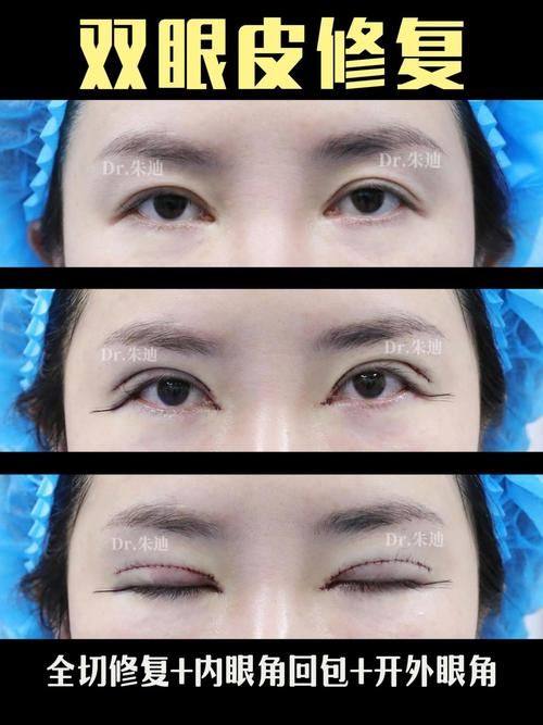 丰城慧尔美医疗美容诊所真人口碑评价怎么样？