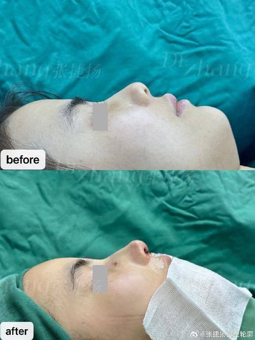 深圳希诺医疗美容门诊部是正规医院吗？