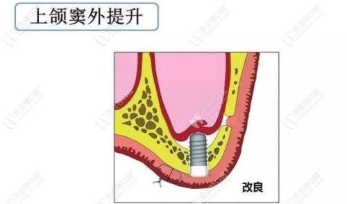 口碑评价及真人实例
