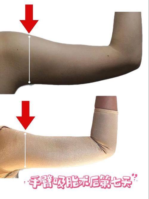 南京维多利亚美容医院是正规医院吗？