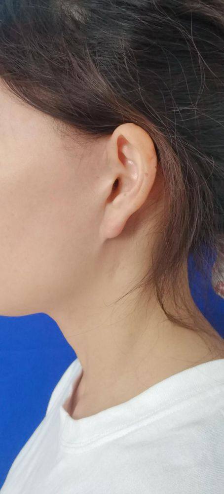 费书宇医生擅长项目