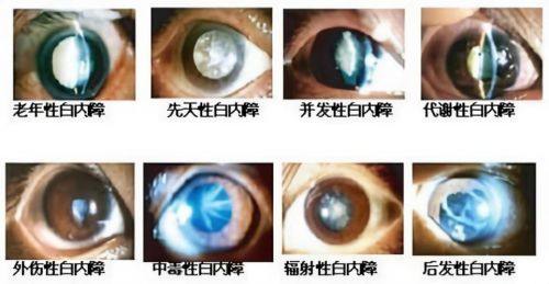 上海金山爱尔眼科医院详细的预约挂号方式及流程