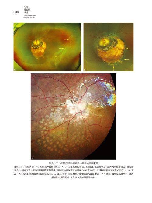 海南省眼科医院收费价格表/收费标准