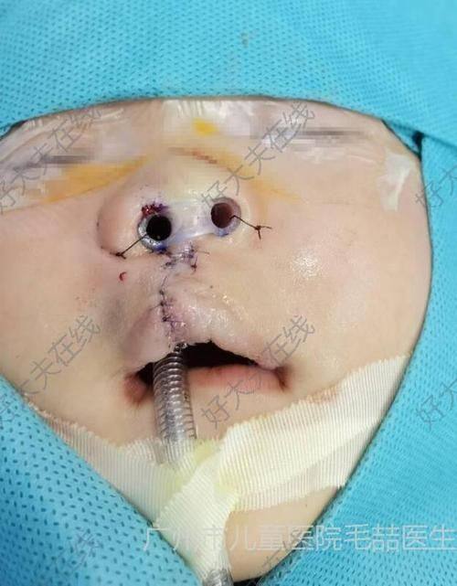 鹤城天姿医疗美容门诊部是正规医院吗?