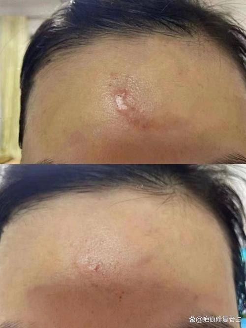 丰城慧尔美医疗美容诊所特色项目及技术优势