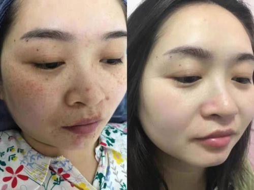 淄博张店德美医疗美容整形医院特色项目及技术优势