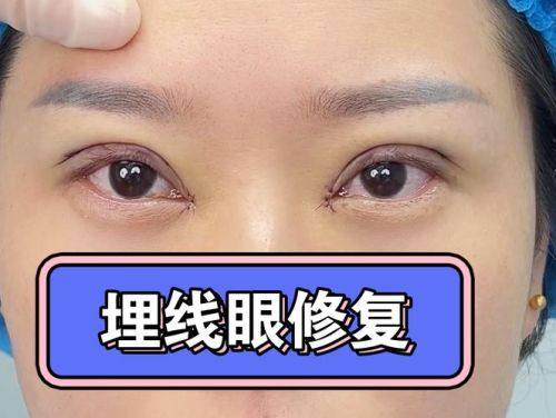 丰城慧尔美医疗美容诊所收费价格表/收费标准