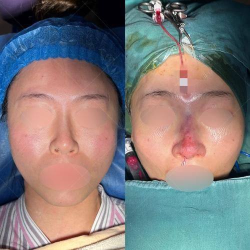 深圳希诺医疗美容门诊部详细的预约挂号方式及流程