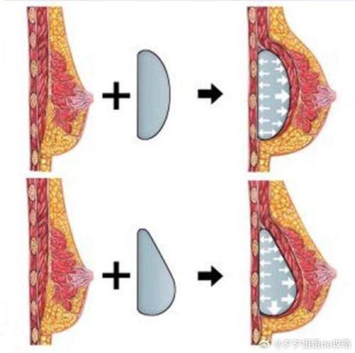 乌兰察布联城东美医疗美容诊所收费价格表/收费标准
