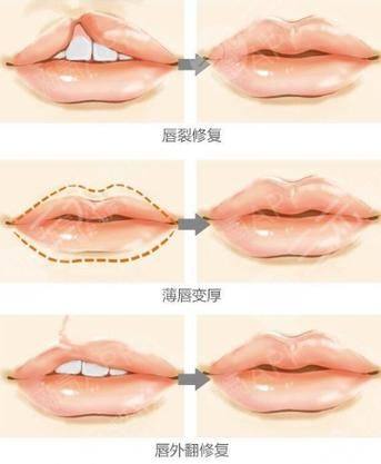 日本LiraCranio面部诊所详细的预约挂号方式及流程