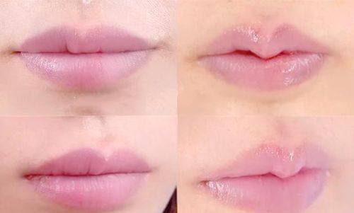 淄博张店德美医疗美容整形医院真人口碑评价怎么样?