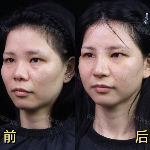 南京维多利亚美容医院特色项目及技术优势