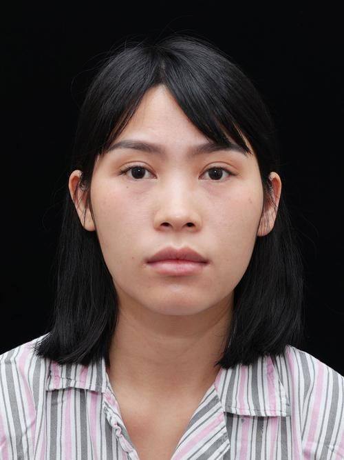 成都生基颐美整形医院收费价格表/收费标准