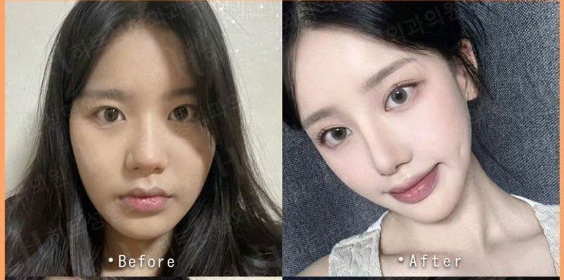 口碑评价及真人实例