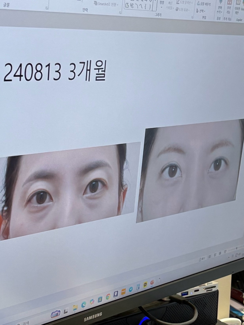 刘芳利医生技术优势