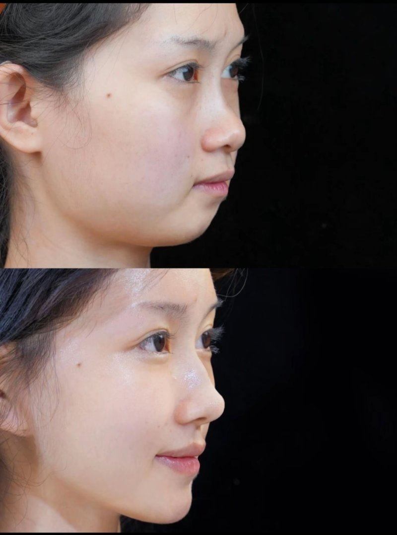 淄博张店德美医疗美容整形医院详细的预约挂号方式及流程