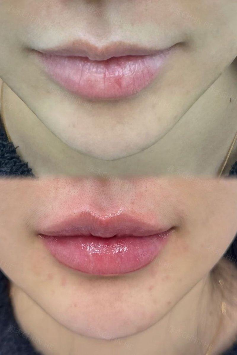 鹤城天姿医疗美容门诊部真人口碑评价怎么样?