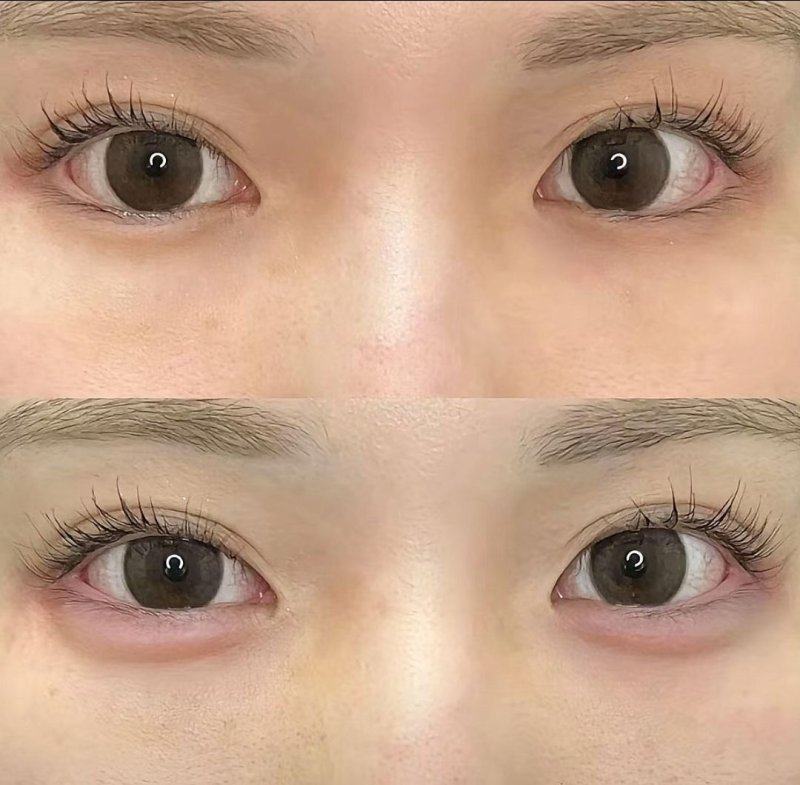 乌兰察布联城东美医疗美容诊所特色项目及技术优势