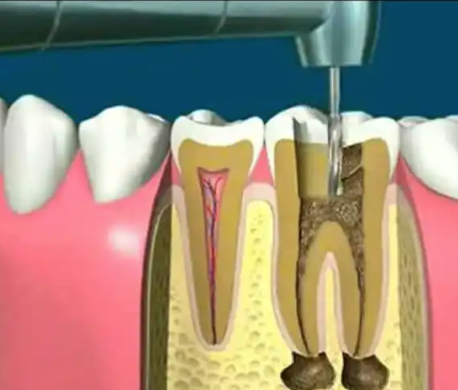 北京欢乐西诺美口腔门诊部详细的预约挂号方式及流程