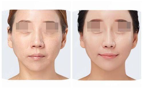 刘剑桥医生口碑评价及真人实例