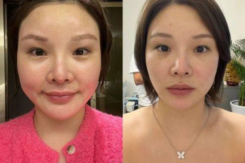 刘芳利医生坐诊医院