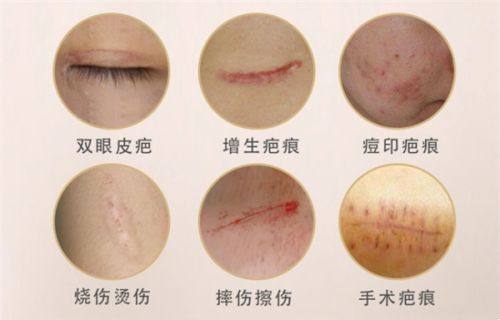 刘剑桥医生技术优势