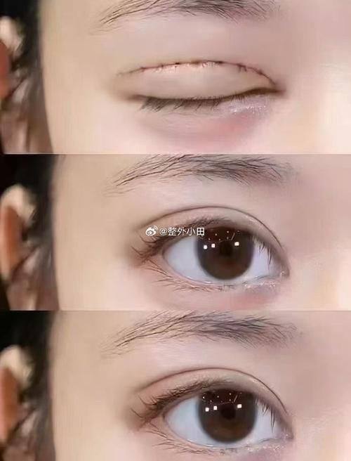 王佑兴医生口碑评价及真人实例